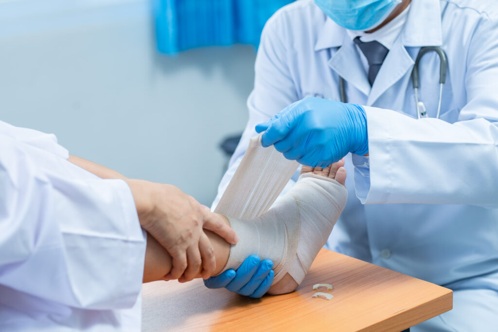 Close-up hand wear medical gloves  Of Doctor Hand Tying Bandage On The Leg Of Patient In Clinic, osteophytes and heel, fascia